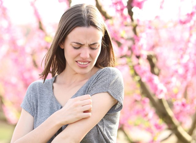 Stressed woman scratching itchy arm after insect bite in a field of peach trees in spring time