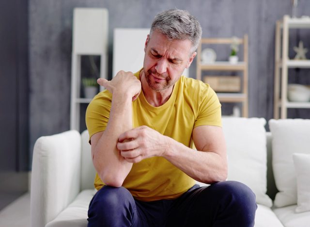 Man With Itchy Skin. Allergy Or Psoriasis