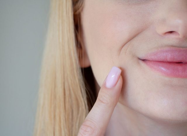 the girl has wrinkles around her mouth
