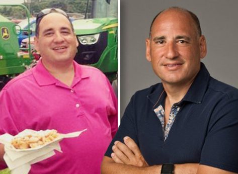 I'm a Doctor and Lost 100 Pounds on the Carnivore Diet